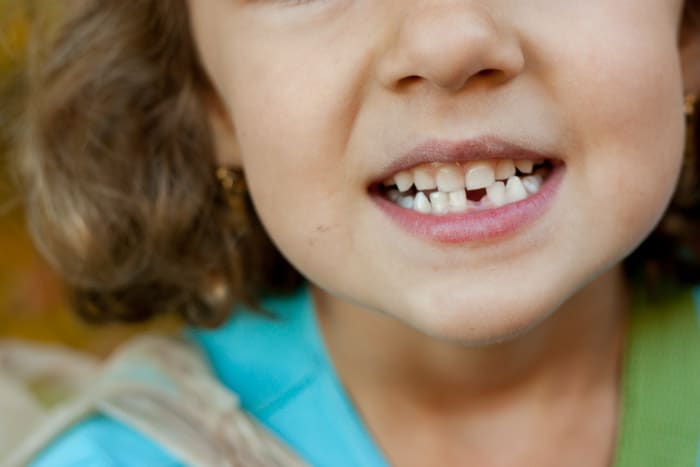 Keep those teeth healthy this Halloween Keep those teeth healthy this Halloween